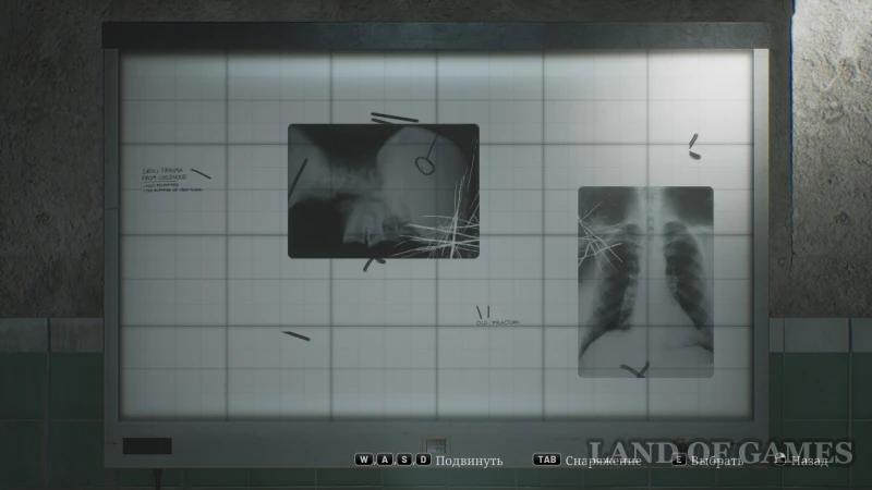 X-ray puzzle in the Silent Hill 2 Remake hospital: how to solve and get the code for room D1