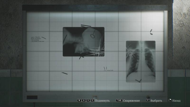 X-ray puzzle in Silent Hill 2 Remake hospital: how to solve and get the code for office D1